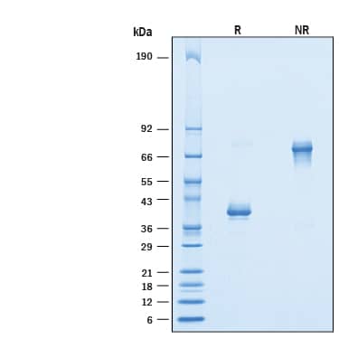 2 μg/lane of Recombinant Human NRG1/HRG1-alpha EGF domain Fc Chimera Protein (Catalog # 11343-NR) was resolved with SDS-PAGE under reducing (R) and non-reducing (NR) conditions and visualized by Coomassie® Blue staining, showing bands at 36-43 kDa and 72-86 kDa, respectively.