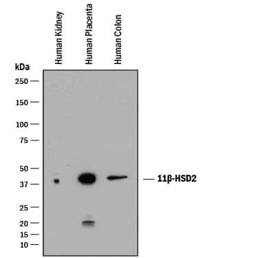 Western blot shows lysates of human kidney tissue, human placenta tissue, and human colon tissue. PVDF membrane was probed with 1 µg/mL of Mouse Anti-Human 11 beta -HSD2 Monoclonal Antibody (Catalog # MAB8630) followed by HRP-conjugated Anti-Mouse IgG Secondary Antibody (Catalog # HAF018). A specific band was detected for 11 beta -HSD2 at approximately 40 kDa (as indicated). This experiment was conducted under reducing conditions and using Immunoblot Buffer Group 1.