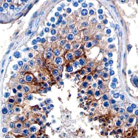 Immunohistochemistry NAALADase-2/NAALAD2 Antibody (756030) [Unconjugated]
