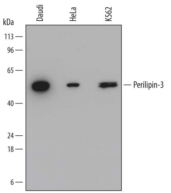 Western blot shows lysates of Daudi human Burkitt's lymphoma cell line, HeLa human cervical epithelial carcinoma cell line, and K562 human chronic myelogenous leukemia cell line. PVDF membrane was probed with 0.5 µg/mL of Mouse Anti-Human Perilipin-3 Monoclonal Antibody (Catalog # MAB7664) followed by HRP-conjugated Anti-Mouse IgG Secondary Antibody (Catalog # HAF018). A specific band was detected for Perilipin-3 at approximately 47 kDa (as indicated). This experiment was conducted under reducing conditions and using Immunoblot Buffer Group 1.