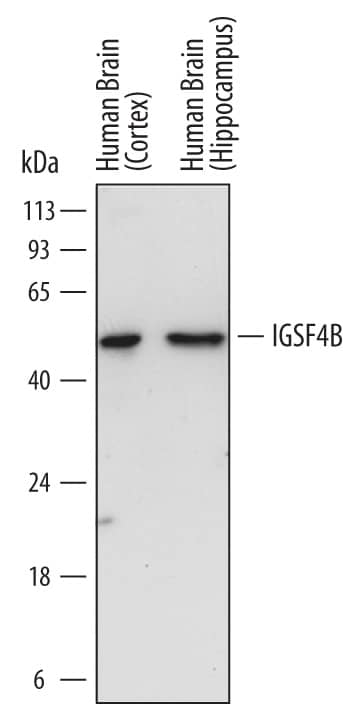 Western blot shows lysates of human brain (cortex) tissue and human brain (hippocampus) tissue. PVDF membrane was probed with 0.2 µg/mL of Mouse Anti-Human IGSF4B/SynCAM3 Monoclonal Antibody (Catalog # MAB36781) followed by HRP-conjugated Anti-Mouse IgG Secondary Antibody (Catalog # HAF007). A specific band was detected for IGSF4B/SynCAM3 at approximately 48 kDa (as indicated). This experiment was conducted under reducing conditions and using Immunoblot Buffer Group 1.