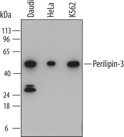 Western blot shows lysates of Daudi human Burkitt's lymphoma cell line, HeLa human cervical epithelial carcinoma cell line, and K562 human chronic myelogenous leukemia cell line. PVDF membrane was probed with 0.25 µg/mL of Mouse Anti-Human Perilipin-3 Monoclonal Antibody (Catalog # MAB76641) followed by HRP-conjugated Anti-Mouse IgG Secondary Antibody (Catalog # HAF018). A specific band was detected for Perilipin-3 at approximately 47 kDa (as indicated). This experiment was conducted under reducing conditions and using Immunoblot Buffer Group 1.