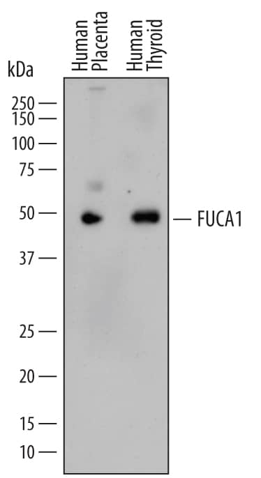 Western blot shows lysates of human placenta tissue and human thyroid tissue. PVDF membrane was probed with 0.2 µg/mL of Mouse Anti-Human Tissue a-L-Fucosidase/FUCA1 Monoclonal Antibody (Catalog # MAB7039) followed by HRP-conjugated Anti-Mouse IgG Secondary Antibody (Catalog # HAF018). A specific band was detected for Tissue a-L-Fucosidase/FUCA1 at approximately 50 kDa (as indicated). This experiment was conducted under reducing conditions and using Immunoblot Buffer Group 1.