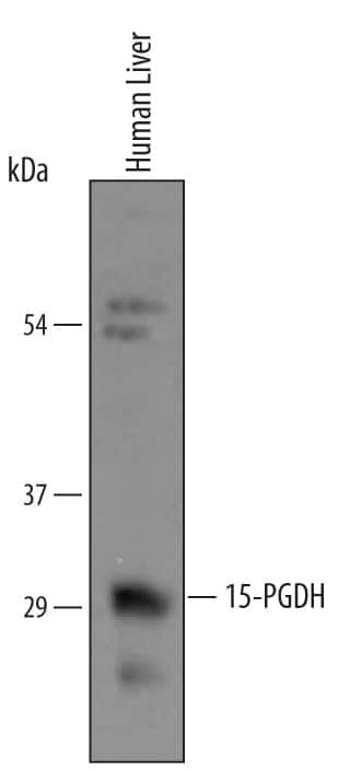 Western blot shows lysates of human liver tissue. PVDF membrane was probed with 1 µg/mL of Goat Anti-Human 15-PGDH/HPGD Antigen Affinity-purified Polyclonal Antibody (Catalog # AF5660) followed by HRP-conjugated Anti-Goat IgG Secondary Antibody (Catalog # HAF019). A specific band was detected for 15-PGDH/HPGD at approximately 29 kDa (as indicated). This experiment was conducted under reducing conditions and using Immunoblot Buffer Group 8.