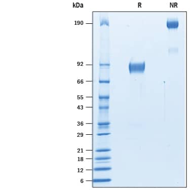 2 μg/lane of Recombinant Mouse SIRP beta 1a Fc Chimera (Catalog # 10334-SB) was  resolved with SDS-PAGE under reducing (R) and non-reducing (NR)  conditions and visualized by Coomassie® Blue staining, showing bands at 83-92 kDa and 160-180 kDa, respectively.
