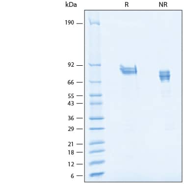 2 μg/lane of Recombinant Human FCRL3/FcRH3 His-tag Protein (Catalog # 3126-FCB) was resolved with SDS-PAGE under reducing (R) and non-reducing (NR) conditions and visualized by Coomassie® Blue staining, showing bands at 70-90 kDa.