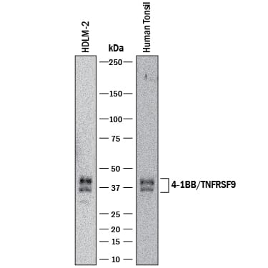 Western blot shows lysates of HDLM-2 human Hodgkin's lymphoma cell line and human tonsil tissue. PVDF membrane was probed with 2 µg/mL of Rabbit Anti-Human 4-1BB/TNFRSF9/CD137 Monoclonal Antibody (Catalog # MAB8381) followed by HRP-conjugated Anti-Rabbit IgG Secondary Antibody (HAF008). Specific bands were detected for 4-1BB/TNFRSF9/CD137 at approximately 32 and 40 kDa (as indicated). This experiment was conducted under reducing conditions and using Immunoblot Buffer Group 1.