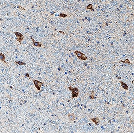     5-HT7  was detected in immersion fixed paraffin-embedded sections of human brain  (hypothalamus) using Mouse Anti-Human 5-HT7 Monoclonal Antibody (Catalog #  MAB10325) at 5 µg/mL for 1 hour at room temperature  followed by incubation with the Anti-Mouse IgG VisUCyte™ HRP  Polymer Antibody (Catalog # VC001).  Before incubation with the primary antibody, tissue was subjected to  heat-induced epitope retrieval using Antigen Retrieval Reagent-Basic (Catalog  # CTS013).  Tissue was stained using DAB (brown) and counterstained with hematoxylin  (blue). Specific staining was localized to cell membrane and cytoplasm in  neurons. View our protocol for IHC  Staining with VisUCyte HRP Polymer Detection Reagents. 