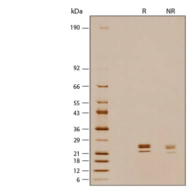 1 μg/lane of Recombinant Human CD40 Ligand/TNFSF5 (HEK293-expressed) Protein (Catalog # 6420-CLB) was resolved with SDS-PAGE under reducing (R) and non-reducing (NR) conditions and visualized by silver staining, showing bands at 20-27 kDa.