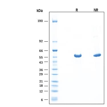 2 μg/lane of Recombinant Yeast ATP‑Sulfurylase/MET3 (Catalog # 7175-AS) was resolved with SDS-PAGE under reducing (R) and non-reducing (NR) conditions and visualized by Coomassie® Blue staining, showing bands at 57-58 kDa.