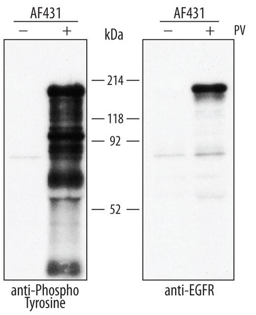 A431 human epithelial carcinoma cell line was untreated (-) or treated (+) with 200 mM pervanadate (PV) for 15 minutes. Phospho-tyrosine was immunoprecipitated from 500 µg of cell lysate following incubation with 10 µg Mouse Anti-Phospho-Tyrosine Agarose-conjugated Monoclonal Antibody (Catalog # AGM1676) for 16 hours at 2 - 8 ºC. Immunoprecipitated phospho-tyrosine was detected by Western blot using 1 µg Phospho-Tyrosine Biotinylated Monoclonal Antibody (left panel, Catalog # BAM1676) or Human EGF R/ErbB1 Biotinylated Antigen Affinity-purified Polyclonal Antibody (right panel, Catalog # BAF231). View our recommended buffer recipes for immunoprecipitation.