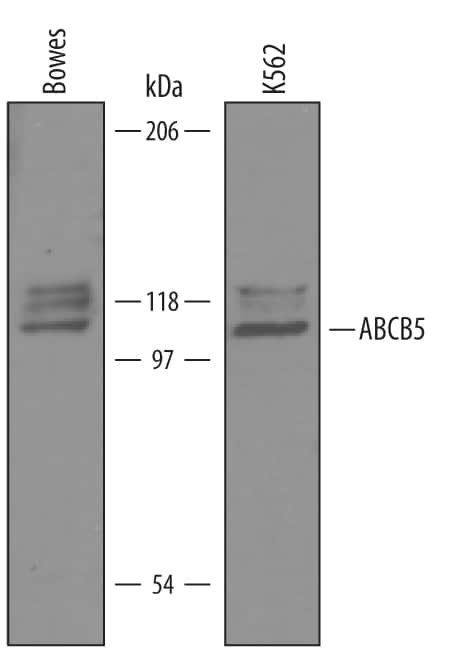Western blot shows lysates of Bowes human melanoma cell line and K562 human chronic myelogenous leukemia cell line. PVDF Membrane was probed with 1 µg/mL of Human ABCB5 Antigen Affinity-purified Polyclonal Antibody (Catalog # AF5799) followed by HRP-conjugated Anti-Sheep IgG Secondary Antibody (Catalog # HAF016). A specific band was detected for ABCB5 at approximately 100-110 kDa (as indicated). This experiment was conducted under reducing conditions and using Immunoblot Buffer Group 8.