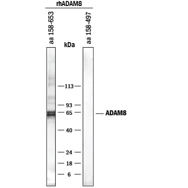 Western blot shows Recombinant Human ADAM8 aa158-653 and Recombinant Human ADAM8 aa 158-497. PVDF membrane was probed with 1 µg/mL of Mouse Anti-Human ADAM8 Monoclonal Antibody (Catalog # MAB10311) followed by HRP-conjugated Anti-Mouse IgG Secondary Antibody (Catalog # HAF018). A specific band was detected for ADAM8 aa158-653 at approximately 65 kDa (as indicated). The antibody did not detect ADAM8 aa 158-497, indicating it is specific for aa 498-653. This experiment was conducted under non-reducing conditions only and using Immunoblot Buffer Group 1.