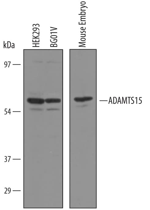 Western blot shows lysates of HEK293 human embryonic kidney cell line, BG01V human embryonic stem cells, and mouse embryo tissue. PVDF Membrane was probed with 1 µg/mL of Human/Mouse ADAMTS15 Antigen Affinity-purified Polyclonal Antibody (Catalog # AF5149) followed by HRP-conjugated Anti-Sheep IgG Secondary Antibody (Catalog # HAF016). A specific band was detected for ADAMTS15 at approximately 75 kDa (as indicated). This experiment was conducted under reducing conditions and using Immunoblot Buffer Group 8.