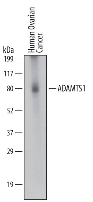 Western blot shows lysates of human ovarian cancer tissue. PVDF membrane was probed with 2 µg/mL of Mouse Anti-Human ADAMTS1 Monoclonal Antibody (Catalog # MAB2197) followed by HRP-conjugated Anti-Mouse IgG Secondary Antibody (Catalog # HAF007). A specific band was detected for ADAMTS1 at approximately 60-70 kDa (as indicated). This experiment was conducted under non-reducing conditions and using Immunoblot Buffer Group 2.