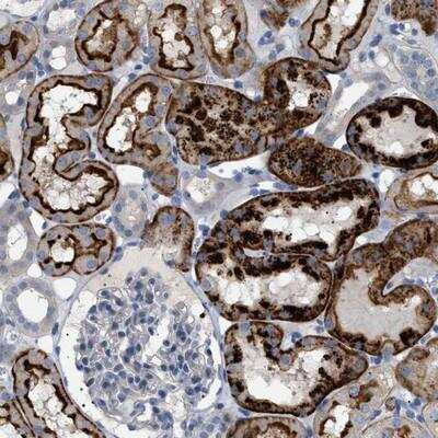 Immunohistochemistry-Paraffin: ADCY10 Antibody [NBP1-81765] - Staining of human kidney shows strong positivity in tubules.