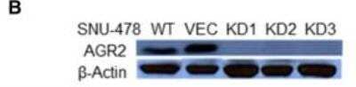 Knockdown Validated: AG-2/AGR2 Antibody [NBP2-27393] - Alterations of tumor-associated phenotypes in AG-2-silenced SNU-478 cells. AG-2 protein expression in SNU-478:VEC and SNU-478:KDs was detected by western blot analysis with beta-actin as a loading control. The result shown is a representative of three experiments. Image collected and cropped by CiteAb from the following publication (//bmccancer.biomedcentral.com/articles/10.1186/1471-2407-14-804), licensed under a CC-BY licence.