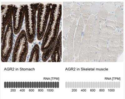 Immunohistochemistry-Paraffin: AG-2 Antibody [NBP1-89212] - Analysis in human stomach and skeletal muscle tissues.  Corresponding AGR2 RNA-seq data are presented for the same tissues.
