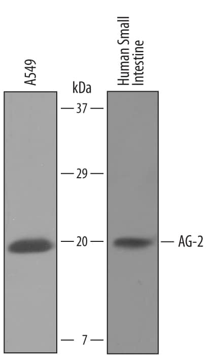 Western blot shows lysates of A549 human lung carcinoma cell line and human small intestine tissue. PVDF Membrane was probed with 1 µg/mL of Sheep Anti-Human AG-2/AGR2 Antigen Affinity-purified Polyclonal Antibody (Catalog # AF6068) followed by HRP-conjugated Anti-Sheep IgG Secondary Antibody (Catalog # HAF016). A specific band was detected for AG-2/AGR2 at approximately 20 kDa (as indicated). This experiment was conducted under reducing conditions and using Immunoblot Buffer Group 8.