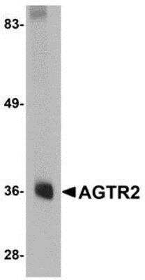 Western Blot: AGTR-2 Antibody [NBP1-77368] - Mouse liver tissue lysate with Angiotensin II Type 2 Receptor antibody at 0.5 ug/ml.