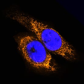 AIF was detected in formaldehyde fixed HeLa human cervical epithelial carcinoma cell line using Sheep Anti-Human/Mouse/Rat AIF Biotinylated Antigen Affinity-purified Polyclonal Antibody (Catalog # BAF5824) at 5 µg/mL overnight at 4 ° C. Cells were stained using the NorthernLights™ 557-conjugated Streptavidin (orange; Catalog # NL999) and counterstained with DAPI (blue). Specific staining was localized to mitochondria. View our protocol for Fluorescent ICC Staining of Cells on Coverslips.