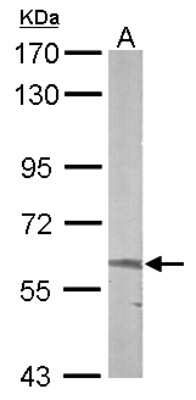 ALAS2 Antibody (NBP1-32826): Novus Biologicals