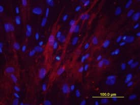 Alkaline Phosphatase/ALPL was detected in immersion fixed differentiated human osteoblasts using Human Alkaline Phosphatase/ALPL Biotinylated Monoclonal Antibody (Catalog # BAM1448) at 10 µg/mL for 3 hours at room temperature. Cells were stained using the NorthernLights™ 557-conjugated Streptavidin (red; Catalog # NL999) and counterstained with DAPI (blue). View our protocol for Fluorescent ICC Staining of Cells on Coverslips.