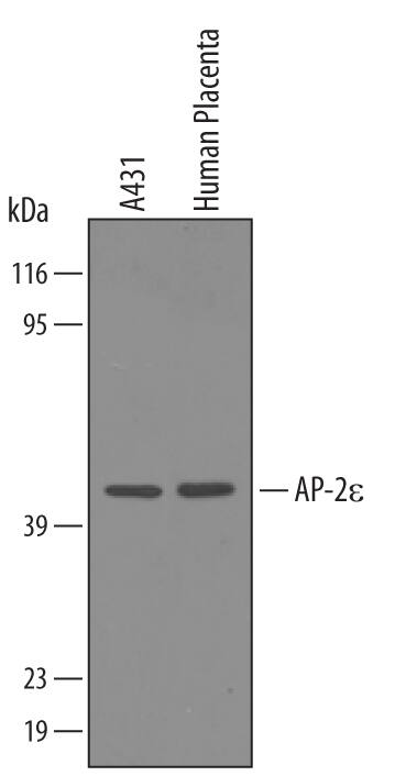 Western Blot AP-2 epsilon/TFAP2E Antibody [Unconjugated]