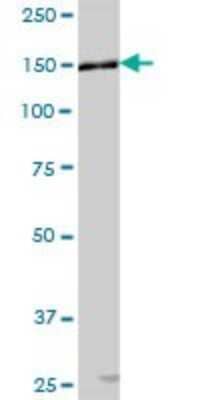 Western Blot: AP3B1 Antibody [H00008546-B01P] - Analysis of AP3B1 expression in human placenta.