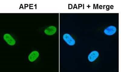 Immunocytochemistry/Immunofluorescence: APE Antibody [NB100-101] - IF on HeLa cells. Image from verified customer review.