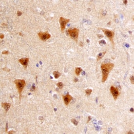 APH1A was detected in immersion fixed paraffin-embedded sections of human Alzheimer's brain using Mouse Anti-Human APH1A Monoclonal Antibody (Catalog # MAB6908) at 15 µg/mL overnight at 4 °C. Before incubation with the primary antibody, tissue was subjected to heat-induced epitope retrieval using Antigen Retrieval Reagent-Basic (Catalog # CTS013). Tissue was stained using the Anti-Mouse HRP-DAB Cell & Tissue Staining Kit (brown; Catalog # CTS002) and counterstained with hematoxylin (blue). Specific staining was localized to neurons. View our protocol for Chromogenic IHC Staining of Paraffin-embedded Tissue Sections.