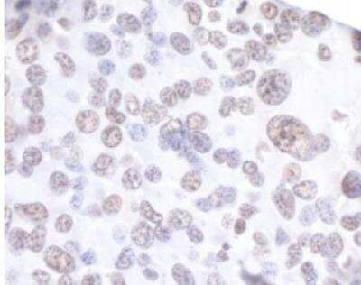 Immunohistochemistry-Paraffin: API5 Antibody [NBP1-46223] - Section of mouse renal cell carcinoma. Antibody: Affinity purified rabbit anti-API5  used at 1:200 (1 ug/ml) Detection: DAB