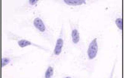 Immunocytochemistry/Immunofluorescence: APJ/Apelin receptor Antibody [NLS65] - Staining of untransfected HEK293 human embryonic kidney cells.