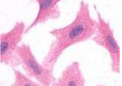 Immunocytochemistry/Immunofluorescence: APJ/Apelin receptor Antibody [NLS65] - Staining of HEK293 human embryonic kidney cells transfected with Apelin Receptor.