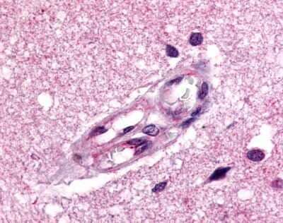 Immunohistochemistry-Paraffin: APJ/Apelin receptor Antibody [NLS65] - Analysis of anti-Apelin Receptor antibody with human brain, vessels.