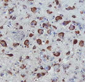     APJ  was detected in immersion fixed paraffin-embedded sections of human  hypothalamus using Mouse Anti-Human APJ Monoclonal Antibody (Catalog #  MAB8561) at 0.5 µg/mL for 1 hour at room temperature  followed by incubation with the Anti-Mouse IgG VisUCyte™  HRP Polymer Antibody (Catalog #  VC001).  Tissue was stained using DAB (brown) and counterstained with hematoxylin  (blue).  Specific staining was  localized to cytoplasm and cell membranes. View our protocol for IHC  Staining with VisUCyte HRP Polymer Detection Reagents. 