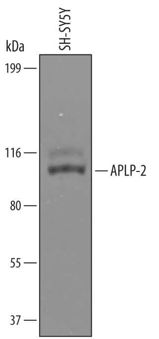 Western blot shows lysates of SH-SY5Y human neuroblastoma cell line. PVDF Membrane was probed with 1 µg/mL of Human APLP-2 Antigen Affinity-purified Polyclonal Antibody (Catalog # AF4945) followed by HRP-conjugated Anti-Goat IgG Secondary Antibody (Catalog # HAF019). A specific band was detected for APLP-2 at approximately 115 kDa (as indicated). This experiment was conducted under reducing conditions and using Immunoblot Buffer Group 1.