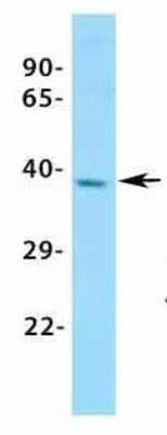 Western Blot: ASGPR1 Antibody [NBP1-54385] - Tissue: MCF7.