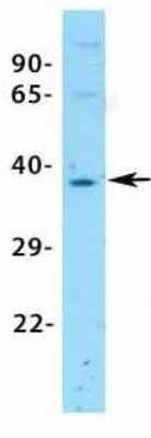 Western Blot: ASGPR1 Antibody [NBP1-54385] - Tissue: 293T.