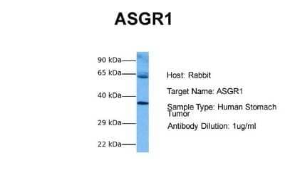 Western Blot: ASGPR1 Antibody [NBP1-54385] - Sample Tissue: Human Stomach Tumor Antibody Dilution: 1.0 ug/ml