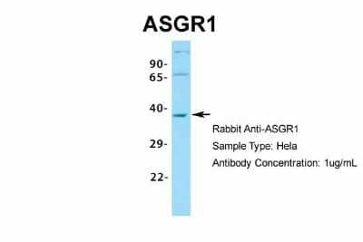 Western Blot: ASGPR1 Antibody [NBP1-54385] - Sample Type: Hela Antibody Dilution: 1.0 ug/ml