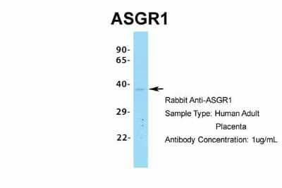 Western Blot: ASGPR1 Antibody [NBP1-54385] - Sample Type: Human Adult Placenta Antibody Dilution: 1.0 ug/ml