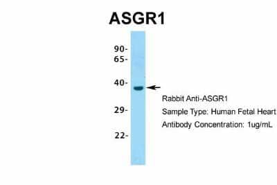 Western Blot: ASGPR1 Antibody [NBP1-54385] - Sample Type: Human Fetal Heart Antibody Dilution: 1.0 ug/ml