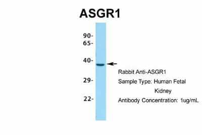 Western Blot: ASGPR1 Antibody [NBP1-54385] - Sample Type: Human Fetal Kidney Antibody Dilution: 1.0 ug/ml