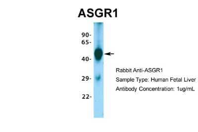 Western Blot: ASGPR1 Antibody [NBP1-54385] - Sample Type: Human Fetal Liver Antibody Dilution: 1.0 ug/ml