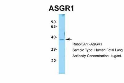 Western Blot: ASGPR1 Antibody [NBP1-54385] - Sample Type: Human Fetal Lung Antibody Dilution: 1.0 ug/ml