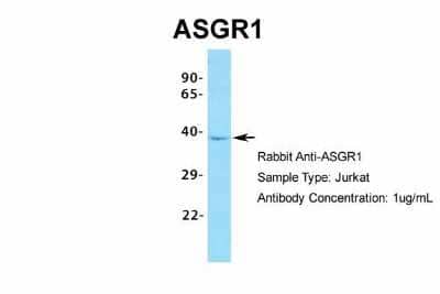 Western Blot: ASGPR1 Antibody [NBP1-54385] - Sample Type: Jurkat Antibody Dilution: 1.0 ug/ml