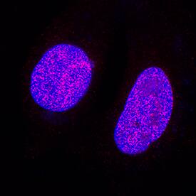 Immunocytochemistry ATAD2 Antibody (952947) [Unconjugated]