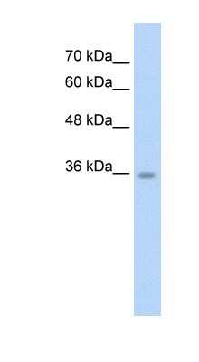 Western Blot: ATAT1 Antibody [NBP1-57690] - HepG2 cell lysate, concentration 2.5 ug/ml.