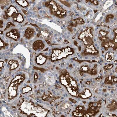 Immunohistochemistry-Paraffin: ATP6V0D1 Antibody [NBP1-88893] - Staining of human kidney shows distinct positivity in extracellular material.